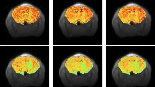 High-sensitivity CEST Image Denoising
